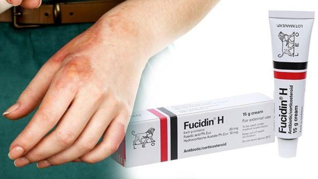 Fucidin Krem Ne işe Yarar? Sivilceye Etkileri, Kullanıcı Yorumları