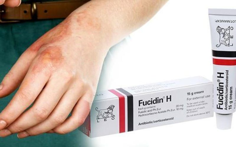 Fucidin Krem Ne işe Yarar? Sivilceye Etkileri, Kullanıcı Yorumları